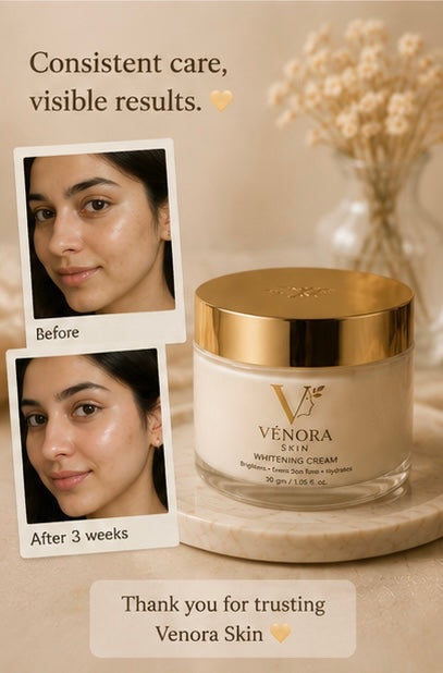 Skin Whitening Cream
